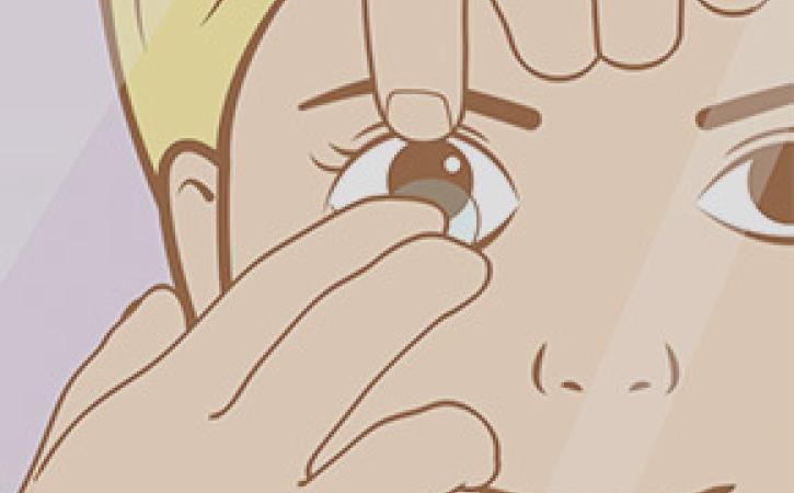 Auf- und Absetzen von MiSight® 1 day Kontaktlinsen Auf- und Absetzen von MiSight® 1 day Kontaktlinsen